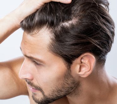 Das Bild zeigt einen Mann, der sich mit der rechten Hand durch die kurzen Haare fährt.